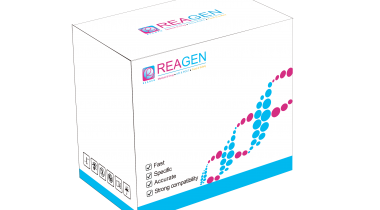 對蝦黃頭病毒（YHV）RNA恒溫核酸檢測試劑盒（不含提?。? />
                            </a>
                        </div>
                                            </div>
                </div>
                <div   id="6666666666"   class="col-lg-5">
                    <div   id="6666666666"   class="product-intro">
                        <h1 class=